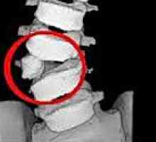Anomálie chrbtice