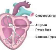 Srdcová arytmia