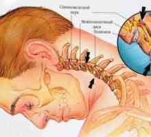 Osteochondróza krčnej chrbtice