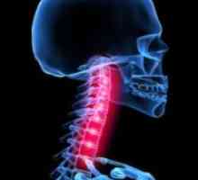 Rozmiestnenie krčnej chrbtice. Príznaky a liečba dislokácie
