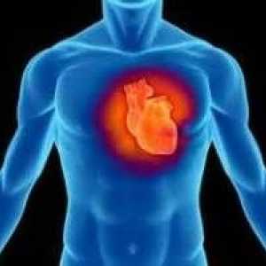 Dilatačná kardiomyopatia