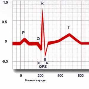Elektrokardiografie (EKG)