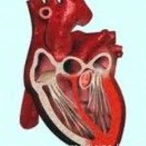 Srdcová astma